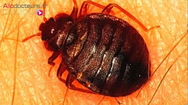Bedbugs: Stop The Invasion!