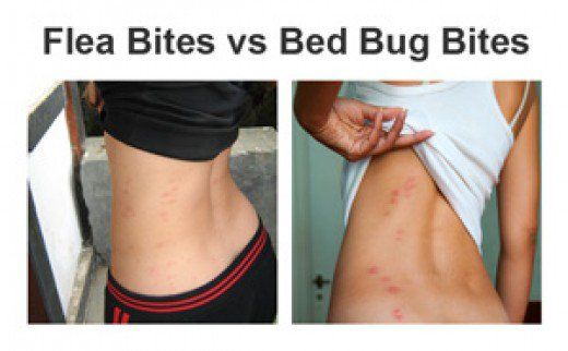 What Can You Put On Your Skin To Repel Bed Bugs – Bed Bug Repellent For Skin | What Can I Put On My Body To Prevent Bed Bug Bites |  Bed Bug Repellent For Skin